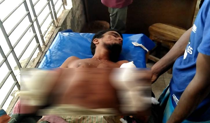 স্বামীর দুই কব্জি কাটলেন স্ত্রী!