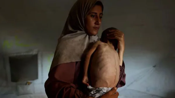 1754794333 5a6a7830e2bcfae9222c46b5459a3aa7