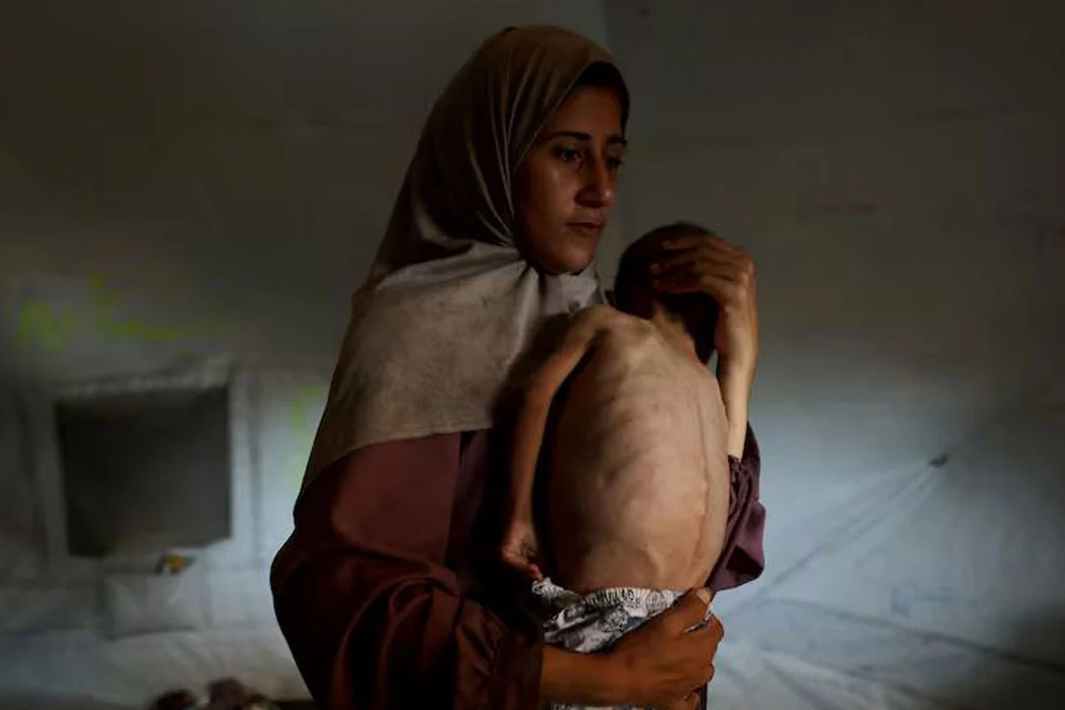 গাজায় অনাহার-অপুষ্টিতে প্রাণ গেল আরও ১১ জনের