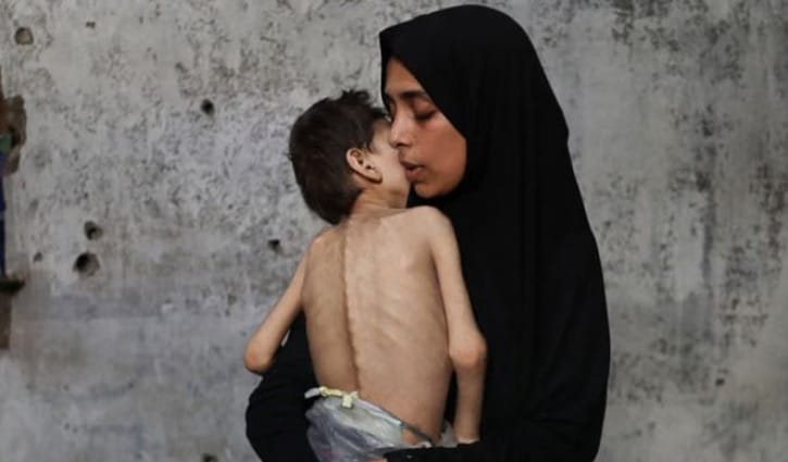 ‘আমরা ধীরে ধীরে মারা যাচ্ছি’