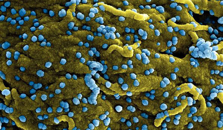 ঘানায় মারবার্গ ভাইরাসের সংক্রমণ