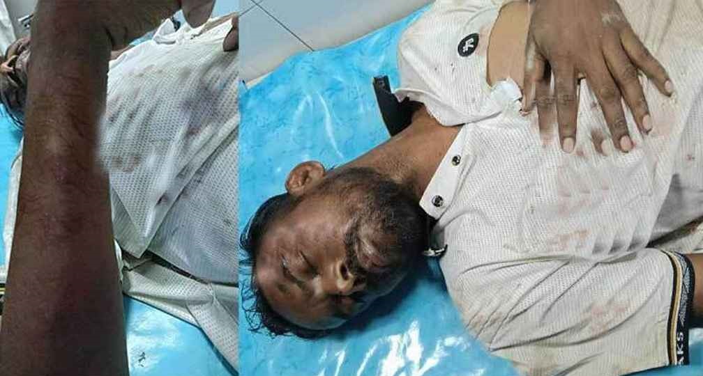 হিরো আলমের ওপর দুর্বৃত্তদের হামলা