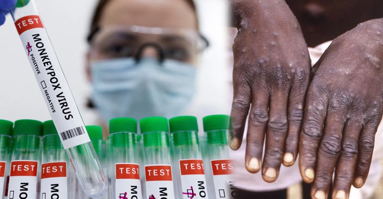 মাঙ্কিপক্সে ভারতে প্রথম মৃত্যু, বাড়ছে আতঙ্ক