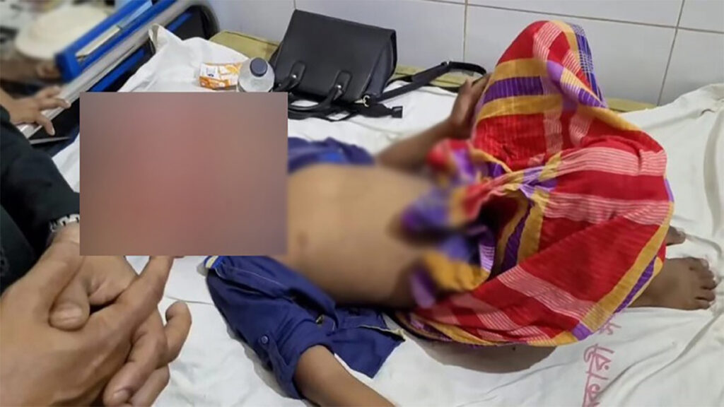 খৎনার সময় শিশুর অতিরিক্ত রক্তপাত, পালালো চিকিৎসক