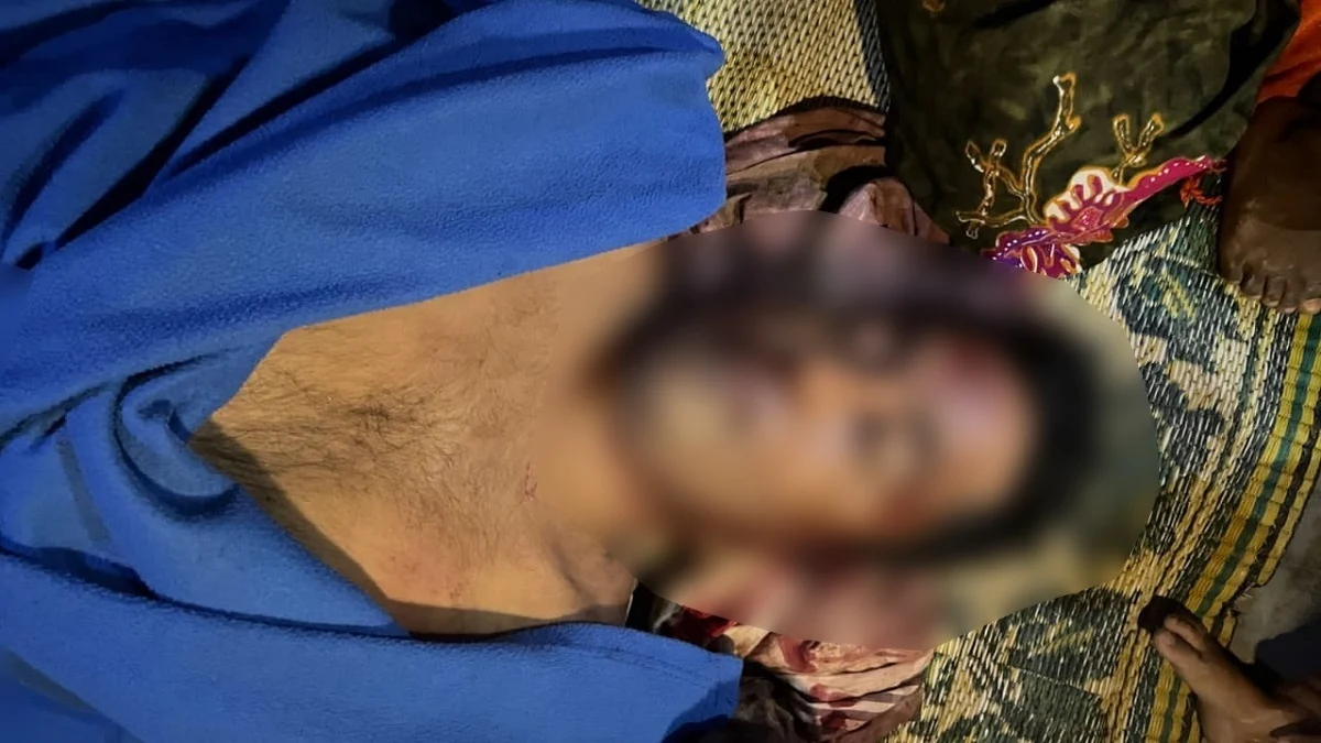 উখিয়ায় রোহিঙ্গা ক্যাম্পে সন্ত্রাসীদের গুলিতে সাব মাঝি নিহত