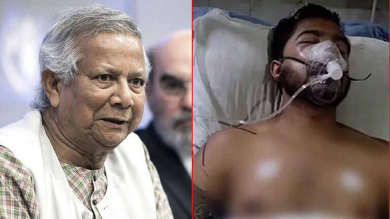 নুরের ওপর হামলাকারীদের বিচার হবে, ভোটও হবে ফেব্রুয়ারিতে: অন্তর্বর্তী সরকারের বিবৃতি